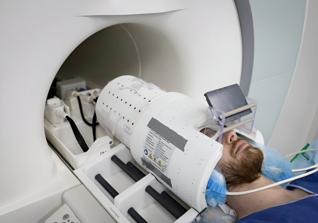 Un nou scaner RMN oferă o precizie de 10 ori mai mare decât cea a aparatelor actuale